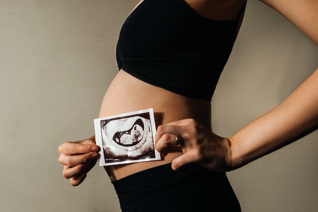 Schwangere Frau, die Embryo-Ultraschallbild vor ihrem Bauch hält.