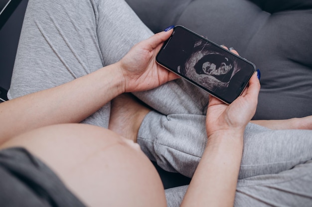 Schwangere Frau, die sich die Ultraschalluntersuchung des Babys aus der Nähe des Scans ansieht