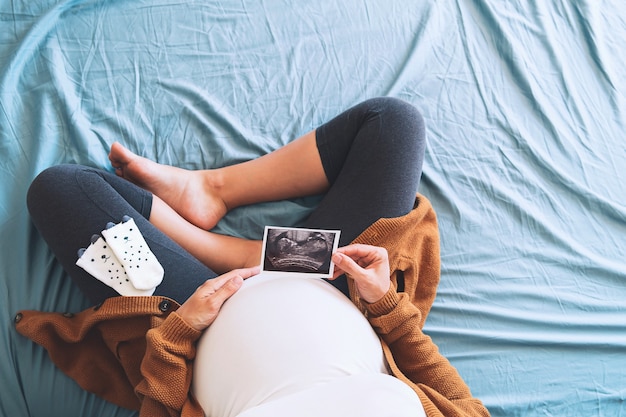 Schwangere Frau, die Ultraschallbild hält Konzept der Schwangerschaftsgesundheitspflege Gynäkologiemedizin