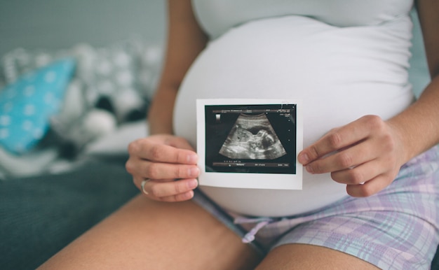 Schwangere frau, die ultraschallscan hält. konzept des schwangerschaftsgesundheitswesens