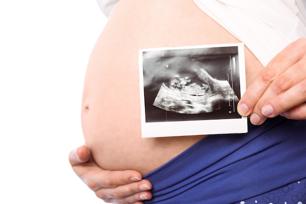 Schwangere Frau, die Ultraschallscans zeigt