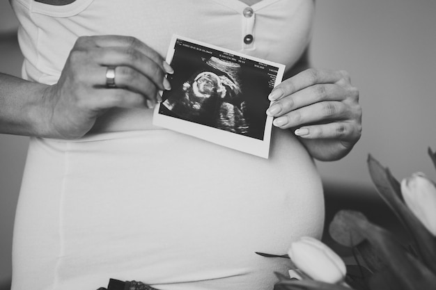 Foto schwangere frau, die ultraschalluntersuchung oder bild auf dem bauch ihrer zukünftigen tochter oder ihres zukünftigen sohns in den armen hält. mädchen erwartet neugeborenes. konzept der mutterschaft. babydusche. schwarzweißfoto.