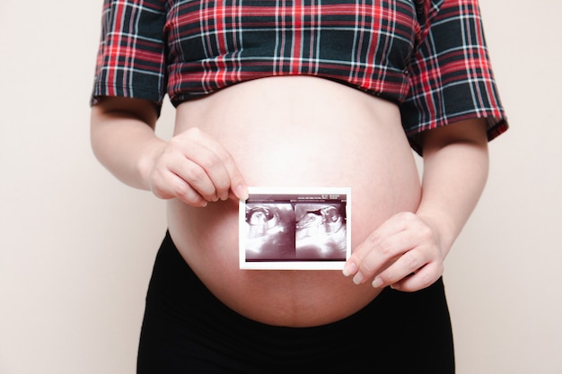 Schwangere Frau mit Ultraschallbild. Eine Mutter wartet auf das Baby.