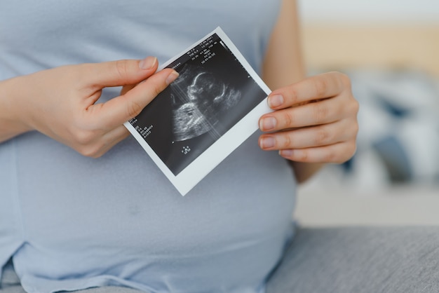 Schwangere hält sich den Bauch und ein Foto von ihrem Ultraschall