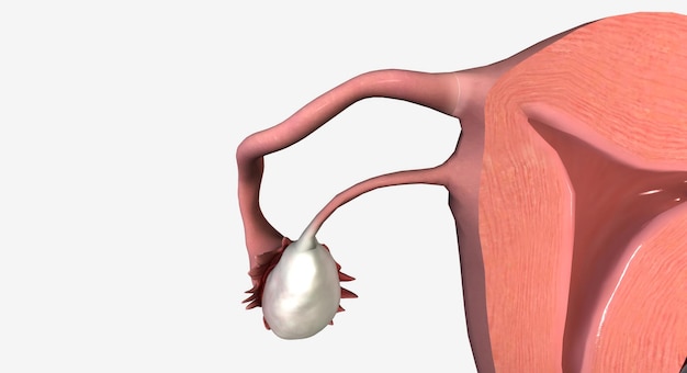 Foto seção coronal do útero vagina