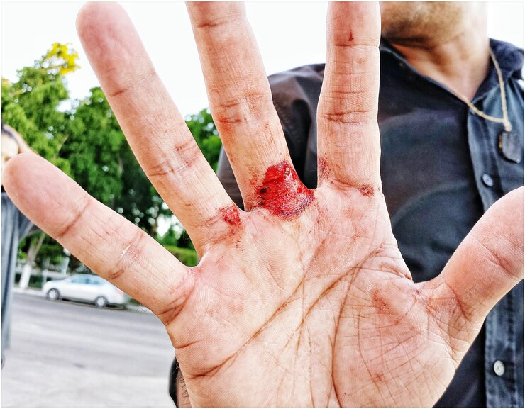Foto seção média de homem com mão ferida