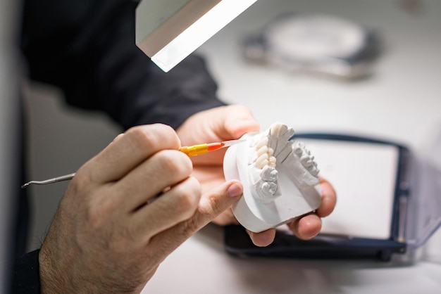 Foto seção média de um dentista examinando próteses dentárias em uma mesa em um hospital