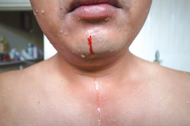 Secção média de um homem com queixo ferido