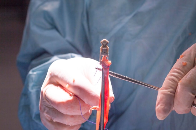 Sección media del cirujano sosteniendo el equipo médico