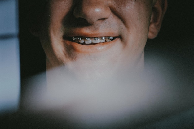 Sección media de un joven sonriente con aparatos ortopédicos