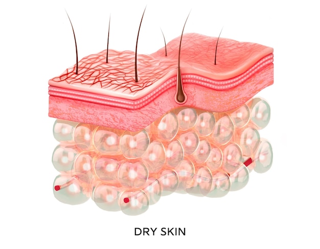 Foto sección transversal de piel seca humana realista de capas ilustración médica aislada 3d piel agrietada