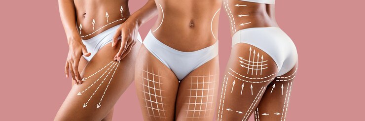 Foto senhoras afro-americanas magras do milênio em lingerie branca com linhas abstratas no corpo