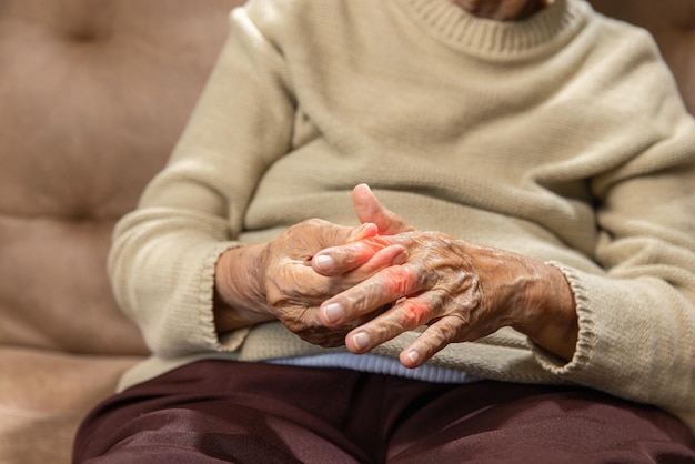 Seniorin Massagefinger mit schmerzhaft geschwollener Gicht