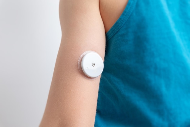 Sensor de glicose no sangue no braço de uma criança. sensor para medição remota dos níveis de glicose no sangue usando a tecnologia nfc em um telefone celular ou leitor