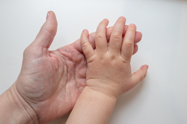 Sequedad e irritación de la piel del niño Alergia infantil