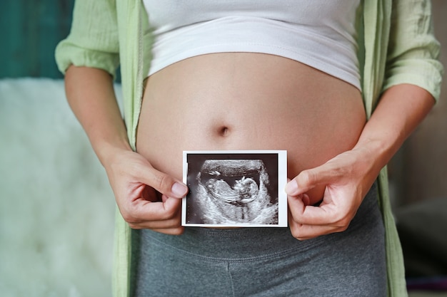 Show-Ultraschallfilm der schwangeren Frau bei der Stellung am Haus.