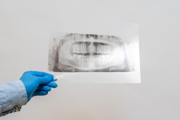 Sicht auf Röntgenbild des Kieferens Zahnröntgenbild der Mundhöhle des Patienten mit Zähnen