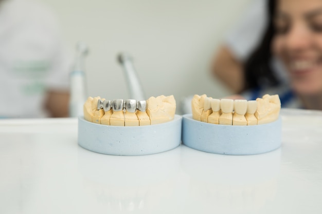 Simulacro de mandíbula en la mesa del dentista