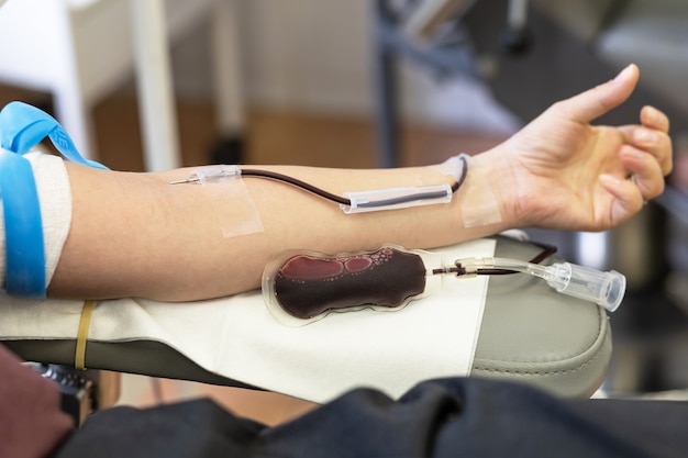 Sistema de transfusão e bolsa de sangue. doador em procedimento de doação.