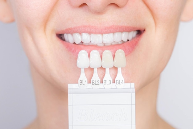 Sonrisa blanca perfecta con guía de sombras color blanqueador blanqueamiento dental blanqueamiento control de calidad y control de color en dentición artificial carilla femenina sonrisa cuidado dental y estomatología