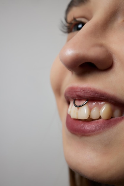 Sonrisa o perforación del frenillo debajo del labio superior.