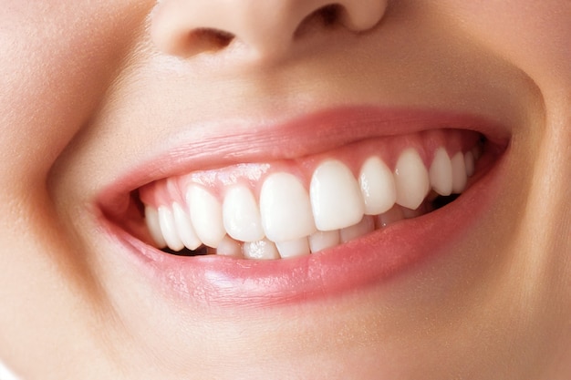 Sonrisa perfecta de dientes sanos de una mujer joven. Blanqueamiento dental. Cuidado dental, concepto de estomatología.