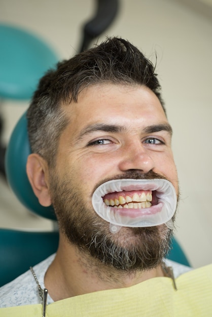 Sorriso bonito do homem europeu com clareamento dos dentes saudáveis.