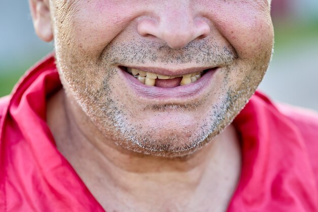 Sorriso desdentado de um idoso com barba da Europa Oriental