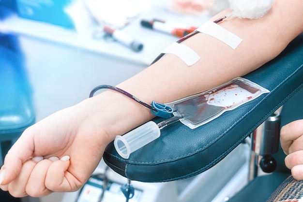 Spender spendet Blut an der Bluttransfusionsstation Frauenhand mit Nahaufnahme Blutspendebeutel Freiwilliger rettet Leben Thema Spende Hintergrund
