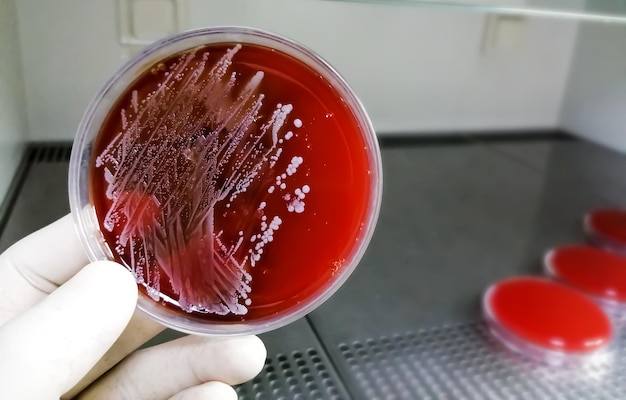 Staphylococcus aureus, eine Art grampositiver Bakterien, wächst auf Blutagarmedien