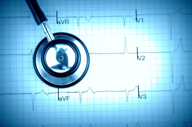 Stethoskop auf dem Elektrokardiogramm (EKG)-Diagramm (Draufsicht)