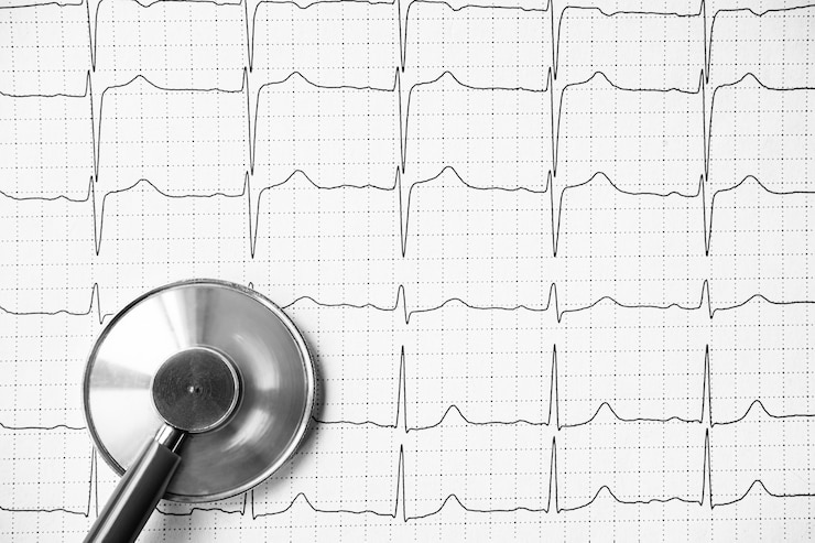 Foto stethoskop auf der ekg-darstellung des elektrokardiogramms von oben. ekg-ausdruck mit stethoskop. medizinisches gesundheitskonzept. auskultation, abhören des herzpulses mit einem stethoskop