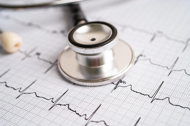 Stethoskop auf Elektrokardiogramm EKG-Herzwellen-Herzinfarkt-Kardiogrammbericht