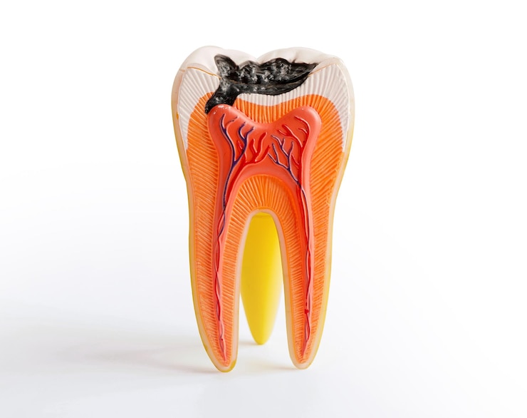 Foto substituição de dentes com cárie por implantes dentários modelo de dentes de canal radicular para educação isolado