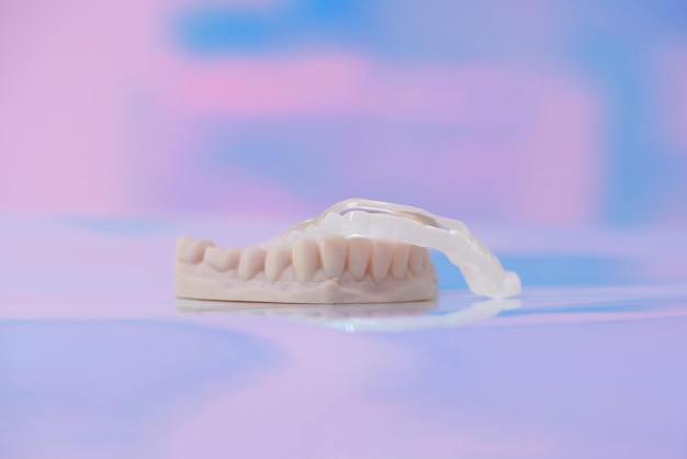 Tapa dental transparente impresa hecha de polímero sobre una férula dental de fondo de colores claros contra