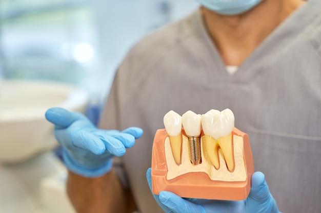 Técnico dentário qualificado posando com um modelo de implante dentário