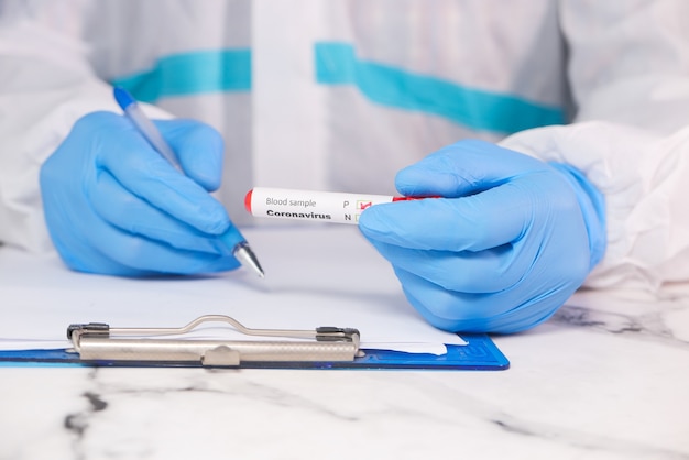 Técnico de laboratorio mano sujetando el tubo de ensayo de sangre