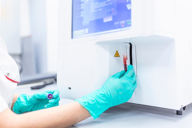 Foto técnico de laboratorio con sangre en tubo con edta para la prueba de laboratorio de hematología de prueba de hemograma completo