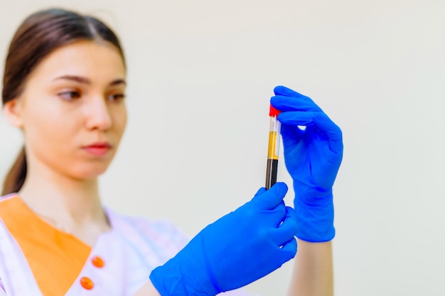 Foto técnico médico segurando tubo de sangue em laboratório equipamento médico exame de sangue