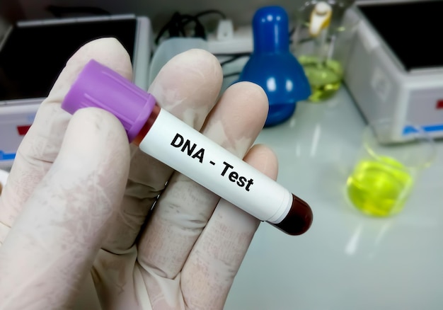 Técnico ou cientista segurando tubo de coleta de sangue de amostra para teste de DNA no laboratório