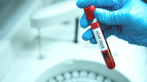 Foto técnico que coloca tubos de sangue na centrífuga de laboratório