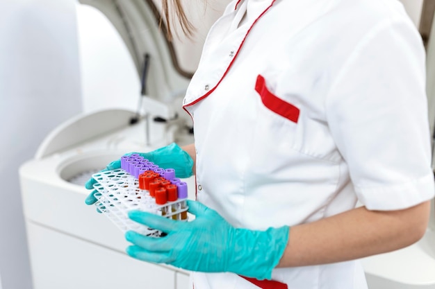 Técnico que realiza la prueba del tubo de sangre en el laboratorio de investigación. Pruebas de coronavirus. Doctor tomando un tubo de muestra de sangre de un estante en el laboratorio