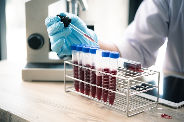 técnico de salud con tubos de sangre en el laboratorio clínico para análisis, médicos, farmacéuticos