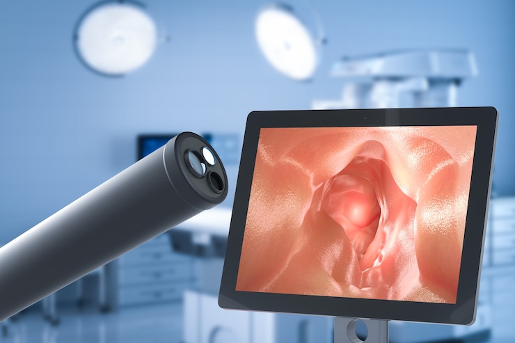 Tecnologia médica com endoscópio com monitor de exibição intestinal