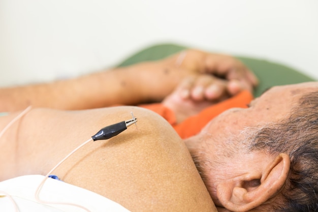 Foto terapeuta dando tratamento de acupuntura para um idoso no hospital