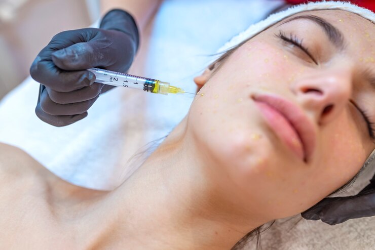 Terapia meso en la frente. Tratamiento de mesoterapia. Procedimiento de mesoterapia. El médico cosmetólogo realiza el procedimiento de mesoterapia en cabeza de mujer. Fortalece el cabello y su crecimiento.