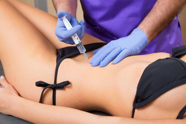 Foto terapia de mesoterapia abdominal doctor tol mujer
