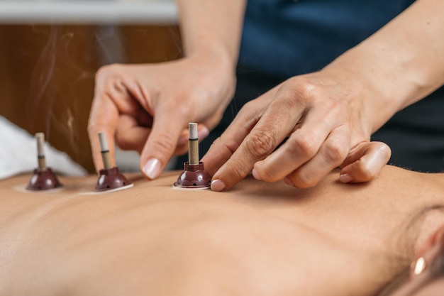 Terapia Moxabustão Medicina Tradicional Chinesa