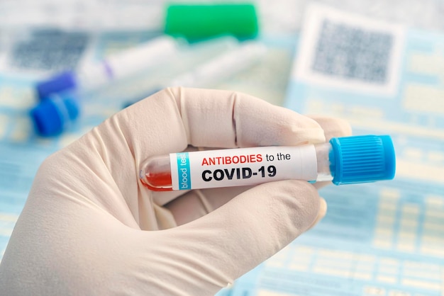 Test auf Antikörper gegen eine Coronavirus-Infektion. Überprüfung der Bevölkerung auf Immunität gegen Covid 19. Ein Reagenzglas mit Bluttest in den Händen eines Arztes vor dem Hintergrund der Laborforschung.