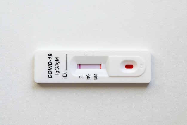 Test mit negativem Ergebnis für das COVID19-Testkit für die Viruserkrankung COVID19 Schnelltest COVID19